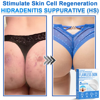 🗽Celsiora® 2-in-1 Microneedle & Hydrocolloid Patch | Raised Moles,Acne,  Flat Warts & Skin Tags Remover | Improves Wrinkles, Scars & Blemishes | Invisible Pimple Patches for Face & Body (Copy)