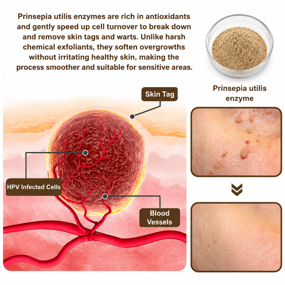 Celsiora®  SkinRepair Essence Cream (Removeswarts and skin growths,improves keratin buildupand seborrheic dermatitis,follicular keratosis, agespots)