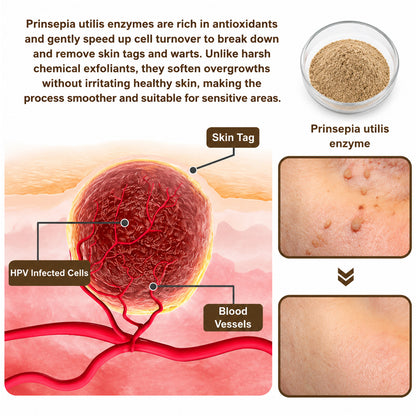 Celsiora®  SkinRepair Essence Cream (Removeswarts and skin growths,improves keratin buildupand seborrheic dermatitis,follicular keratosis, agespots)