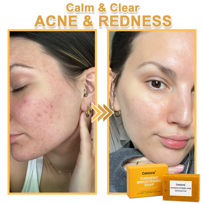 UPSELL🔥BUY 2 GET 1 FREE🔥Turmeric Brightening Soap (with Vitamin C, Alpha Arbutin, Oat)-Celsiora®