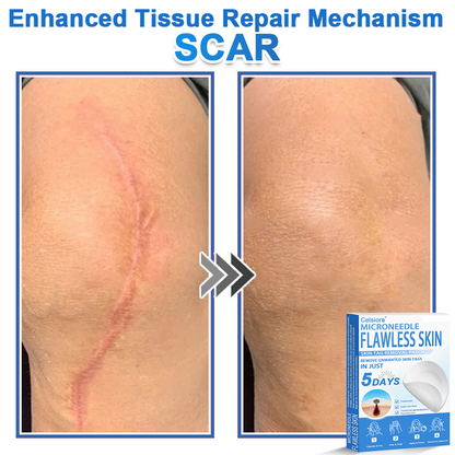 🗽Celsiora® 2-in-1 Microneedle & Hydrocolloid Patch | Raised Moles,Acne,  Flat Warts & Skin Tags Remover | Improves Wrinkles, Scars & Blemishes | Invisible Pimple Patches for Face & Body (Copy)