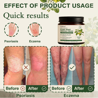 Celsiora®  SkinRepair Essence Cream (Removeswarts and skin growths,improves keratin buildupand seborrheic dermatitis,follicular keratosis, agespots)