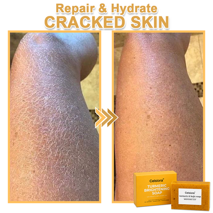 UPSELL🔥BUY 2 GET 1 FREE🔥Turmeric Brightening Soap (with Vitamin C, Alpha Arbutin, Oat)-Celsiora®