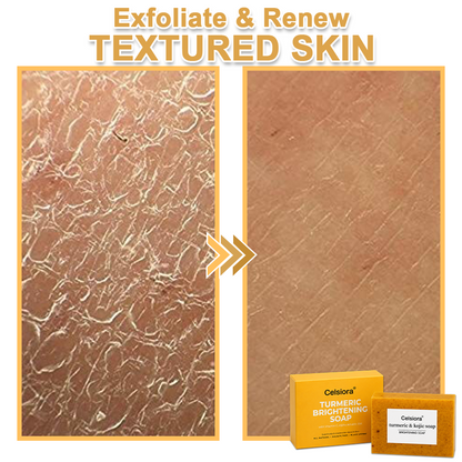 UPSELL🔥BUY 2 GET 1 FREE🔥Turmeric Brightening Soap (with Vitamin C, Alpha Arbutin, Oat)-Celsiora®