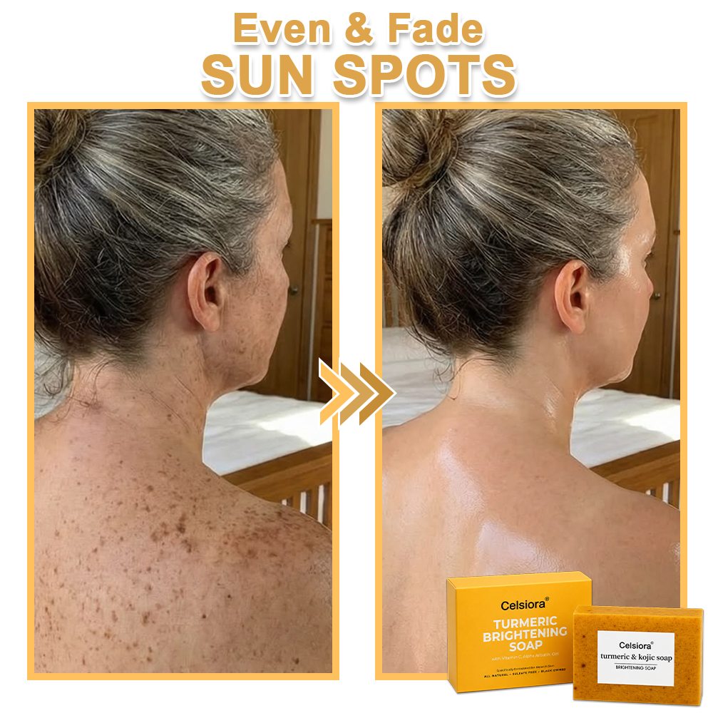 UPSELL🔥BUY 2 GET 1 FREE🔥Turmeric Brightening Soap (with Vitamin C, Alpha Arbutin, Oat)-Celsiora®