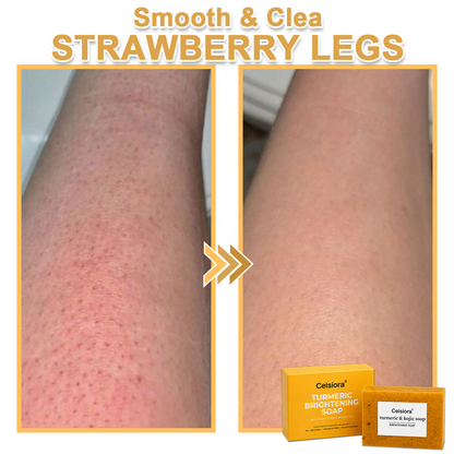 UPSELL🔥BUY 2 GET 1 FREE🔥Turmeric Brightening Soap (with Vitamin C, Alpha Arbutin, Oat)-Celsiora®