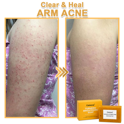 UPSELL🔥BUY 2 GET 1 FREE🔥Turmeric Brightening Soap (with Vitamin C, Alpha Arbutin, Oat)-Celsiora®