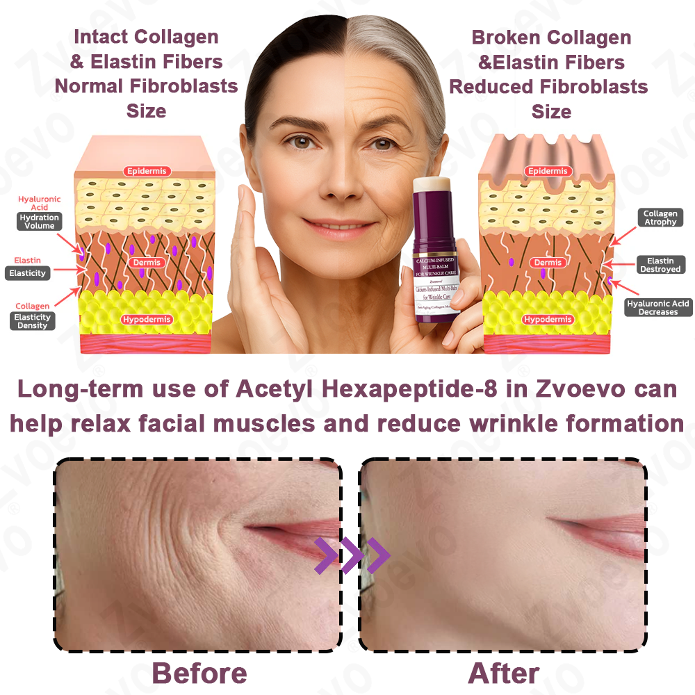 Celsiora® 💄PDRN Collagen Repair Balm (Targets wrinkles and fine lines, smooths nasolabial folds and neck wrinkles, reduces frown lines and crow's feet)