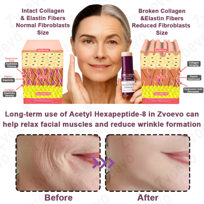 Celsiora® 💄PDRN Collagen Repair Balm (Targets wrinkles and fine lines, smooths nasolabial folds and neck wrinkles, reduces frown lines and crow's feet)