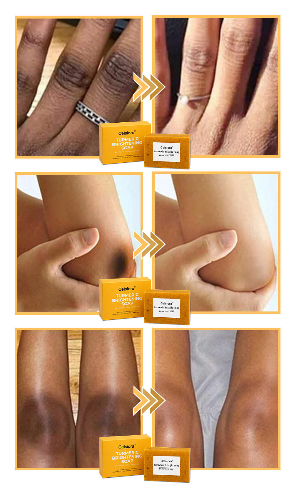 UPSELL🔥BUY 2 GET 1 FREE🔥Turmeric Brightening Soap (with Vitamin C, Alpha Arbutin, Oat)-Celsiora®