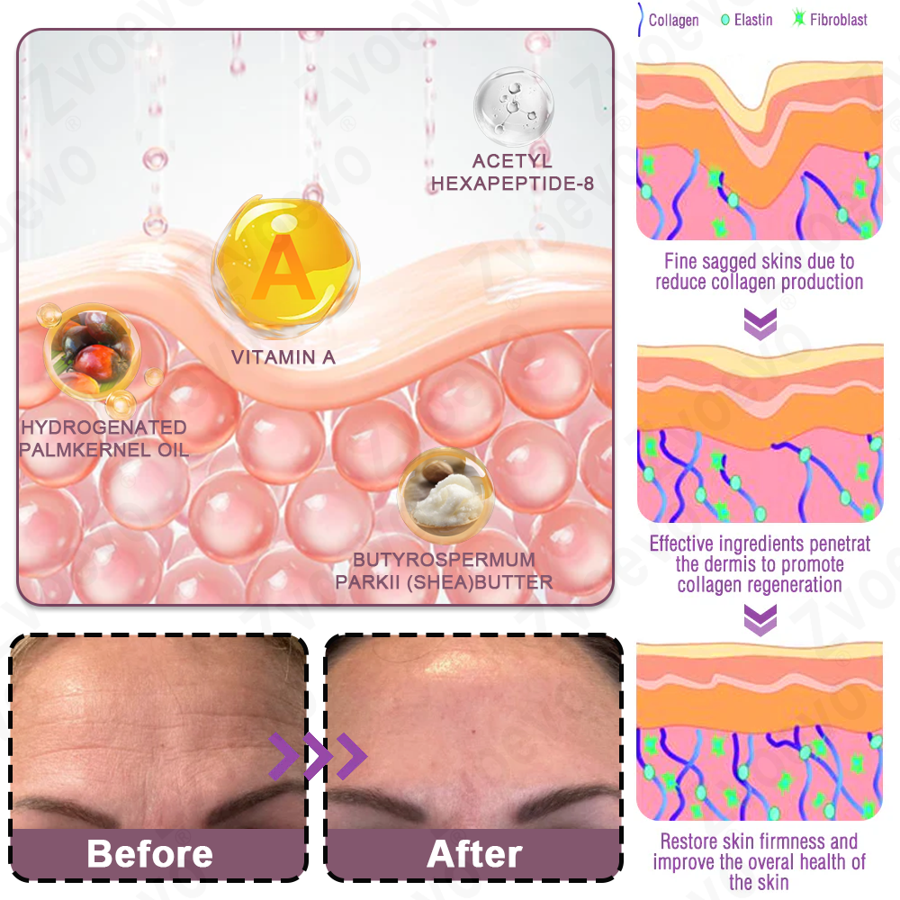 Celsiora® 💄PDRN Collagen Repair Balm (Targets wrinkles and fine lines, smooths nasolabial folds and neck wrinkles, reduces frown lines and crow's feet)