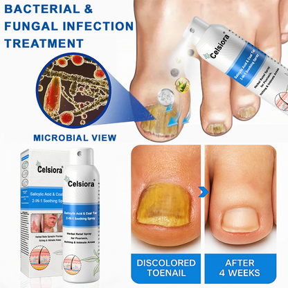 Psoriasis✅ Official Store: Celsiora® SALICYLIC ACID& COAL TAR 2-IN-1 Psoriasis Spray 👨‍⚕️ Developed by Dermatologists (for the treatment of psoriasis and eczema, improvement of bacterial infections in the genital area) Made in USA