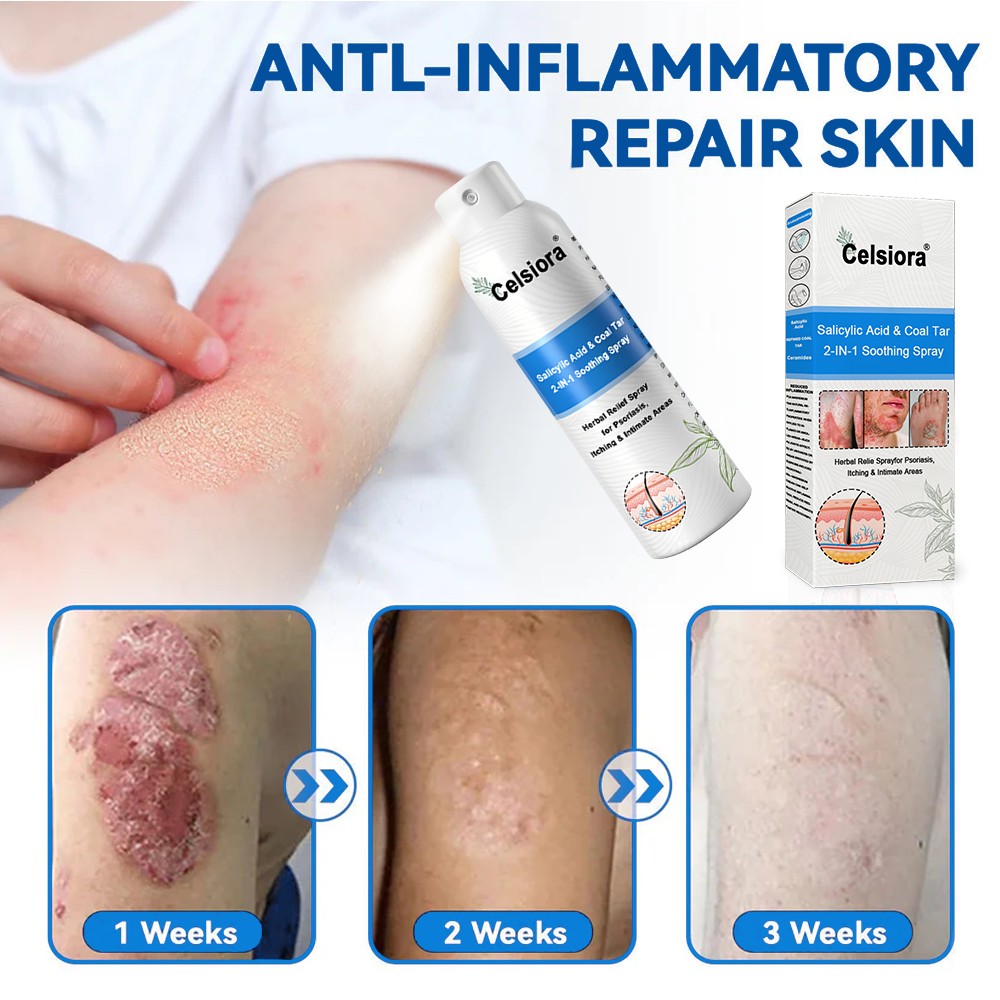 Psoriasis✅ Official Store: Celsiora® SALICYLIC ACID& COAL TAR 2-IN-1 Psoriasis Spray 👨‍⚕️ Developed by Dermatologists (for the treatment of psoriasis and eczema, improvement of bacterial infections in the genital area) Made in USA