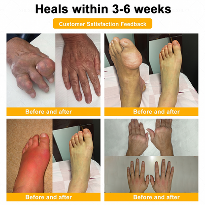 UPSELL✅Anti-Aging Cellular Repair: Celsiora® Pain-Relief Bone Healing Cream (Treatment for Osteoarthritis, Rheumatoid Arthritis,Sports Injuries,  Compressed Nerves, and Chronic Muscle Strain) (Copy)
