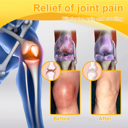 UPSELL✅Anti-Aging Cellular Repair: Celsiora® Pain-Relief Bone Healing Cream (Treatment for Osteoarthritis, Rheumatoid Arthritis,Sports Injuries,  Compressed Nerves, and Chronic Muscle Strain) (Copy)