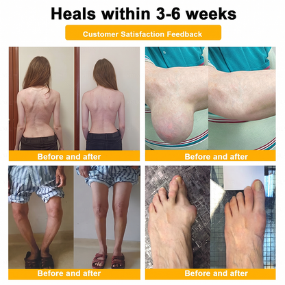 UPSELL✅Anti-Aging Cellular Repair: Celsiora® Pain-Relief Bone Healing Cream (Treatment for Osteoarthritis, Rheumatoid Arthritis,Sports Injuries,  Compressed Nerves, and Chronic Muscle Strain) (Copy)
