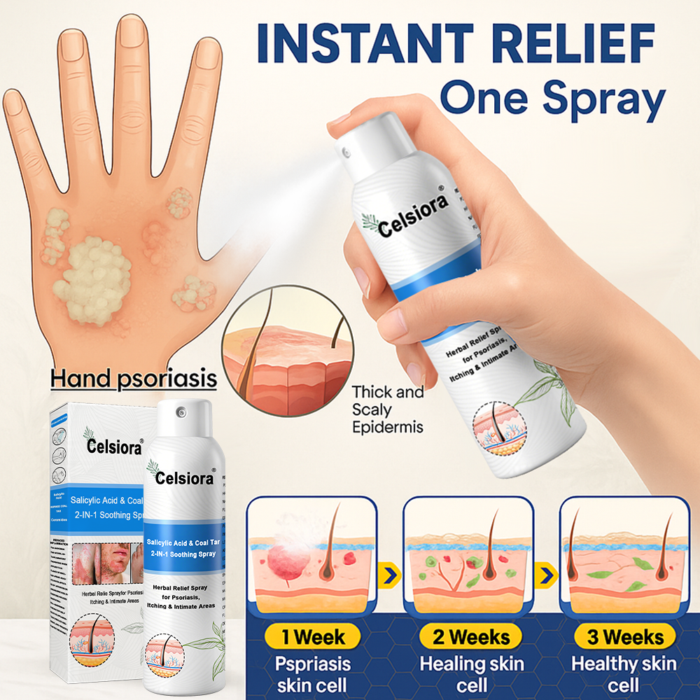 Psoriasis✅ Official Store: Celsiora® SALICYLIC ACID& COAL TAR 2-IN-1 Psoriasis Spray 👨‍⚕️ Developed by Dermatologists (for the treatment of psoriasis and eczema, improvement of bacterial infections in the genital area) Made in USA