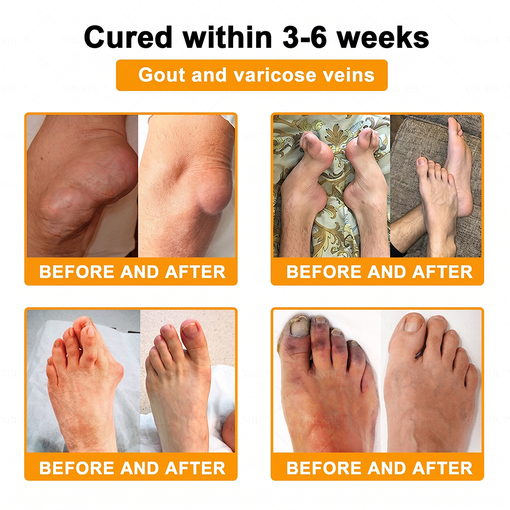 UPSELL✅Anti-Aging Cellular Repair: Celsiora® Pain-Relief Bone Healing Cream (Treatment for Osteoarthritis, Rheumatoid Arthritis,Sports Injuries,  Compressed Nerves, and Chronic Muscle Strain) (Copy)