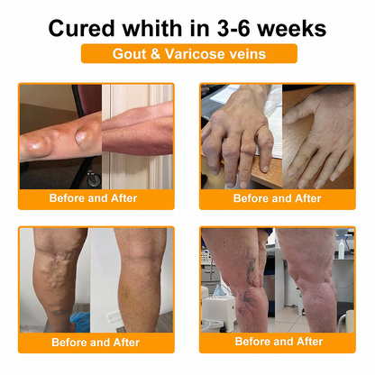 UPSELL✅Anti-Aging Cellular Repair: Celsiora® Pain-Relief Bone Healing Cream (Treatment for Osteoarthritis, Rheumatoid Arthritis,Sports Injuries,  Compressed Nerves, and Chronic Muscle Strain) (Copy)