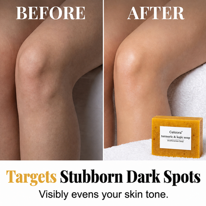 UPSELL🔥BUY 2 GET 1 FREE🔥Turmeric Brightening Soap (with Vitamin C, Alpha Arbutin, Oat)-Celsiora®