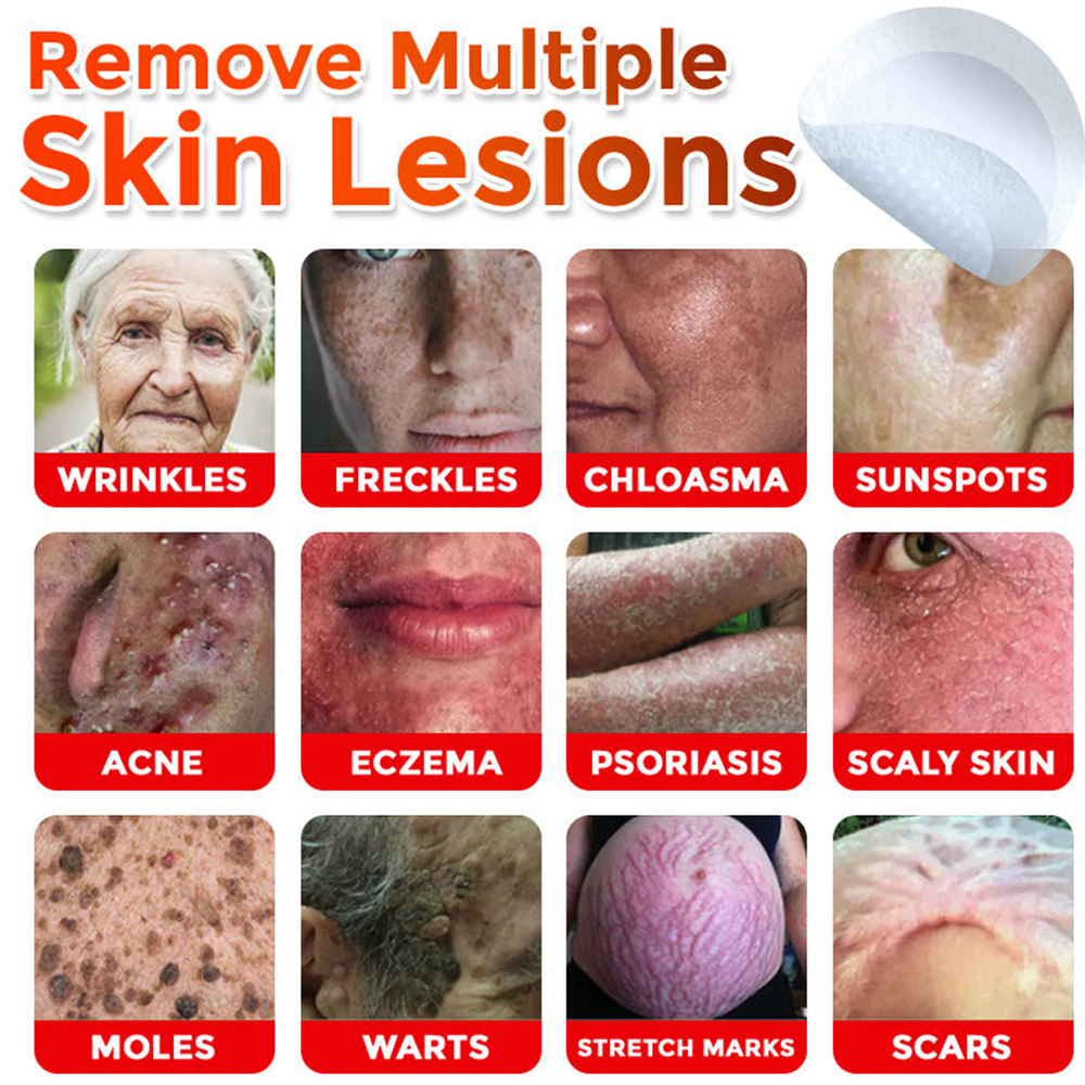 upsell🎀Celsiora® 2-in-1 Microneedle & Hydrocolloid Patch | Raised Moles,Acne,  Flat Warts & Skin Tags Remover | Improves Wrinkles, Scars & Blemishes | Invisible Pimple Patches for Face & Body