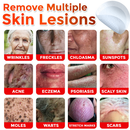upsell🎀Celsiora® 2-in-1 Microneedle & Hydrocolloid Patch | Raised Moles,Acne,  Flat Warts & Skin Tags Remover | Improves Wrinkles, Scars & Blemishes | Invisible Pimple Patches for Face & Body