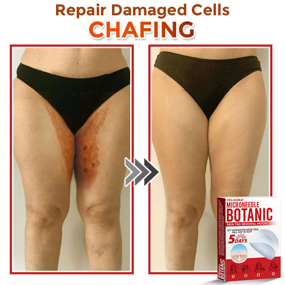 upsell🎀Celsiora® 2-in-1 Microneedle & Hydrocolloid Patch | Raised Moles,Acne,  Flat Warts & Skin Tags Remover | Improves Wrinkles, Scars & Blemishes | Invisible Pimple Patches for Face & Body