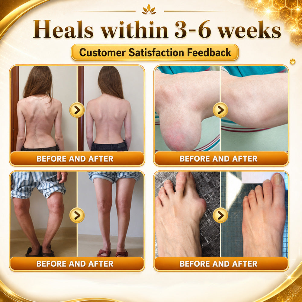 🦴Anti-Aging Cellular Repair: Celsiora® Pain-Relief Bone Healing Cream (Treatment for Osteoarthritis, Rheumatoid Arthritis,Sports Injuries,  Compressed Nerves, and Chronic Muscle Strain)
