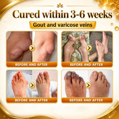 🦴Anti-Aging Cellular Repair: Celsiora® Pain-Relief Bone Healing Cream (Treatment for Osteoarthritis, Rheumatoid Arthritis,Sports Injuries,  Compressed Nerves, and Chronic Muscle Strain)