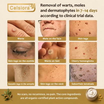 🌸Celsiora® 🌸Organic Tallow Honey Balm to Help Helps remove warts, skin tags, and psoriasis