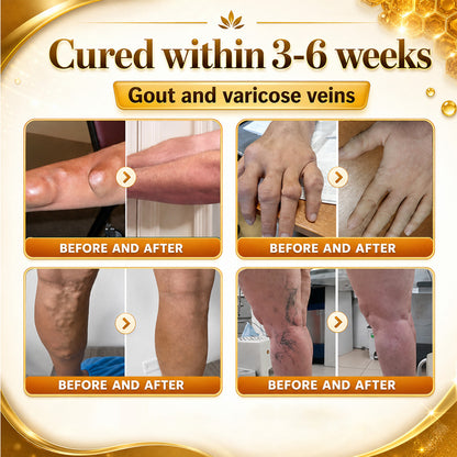 🦴Anti-Aging Cellular Repair: Celsiora® Pain-Relief Bone Healing Cream (Treatment for Osteoarthritis, Rheumatoid Arthritis,Sports Injuries,  Compressed Nerves, and Chronic Muscle Strain)