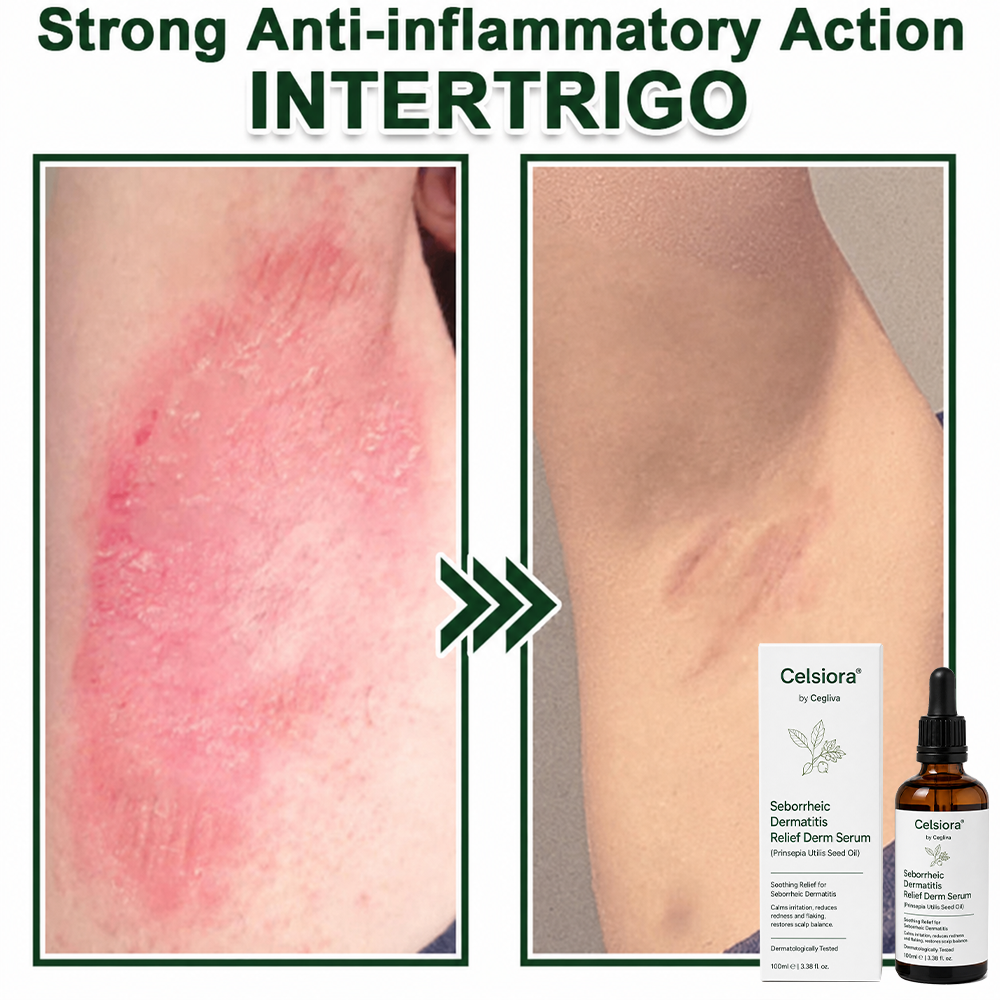 🍀Celsiora® Seborrheic Dermatitis Relief Derm Serum