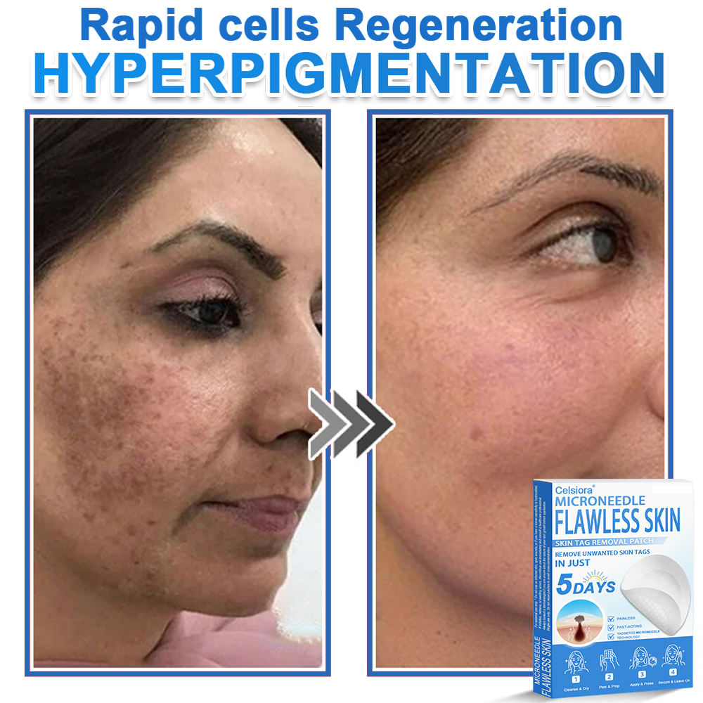 🗽Celsiora® 2-in-1 Microneedle & Hydrocolloid Patch | Raised Moles,Acne,  Flat Warts & Skin Tags Remover | Improves Wrinkles, Scars & Blemishes | Invisible Pimple Patches for Face & Body (Copy)