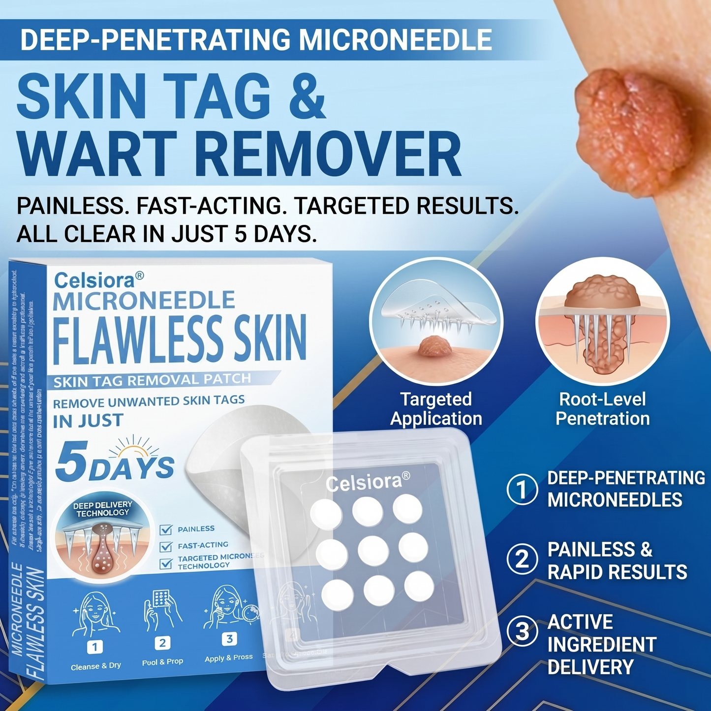 ⏱️Celsiora® 2-in-1 Microneedle & Hydrocolloid Patch | Raised Moles,Acne,  Flat Warts & Skin Tags Remover | Improves Wrinkles, Scars & Blemishes | Invisible Pimple Patches for Face & Body