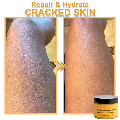✨️BUY 2 GET 1 FREE✨️Turmeric Exfoliating For Face & Body Scrub-Celsiora®
