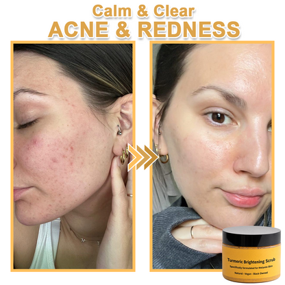 ✨️BUY 2 GET 1 FREE✨️Turmeric Exfoliating For Face & Body Scrub-Celsiora®