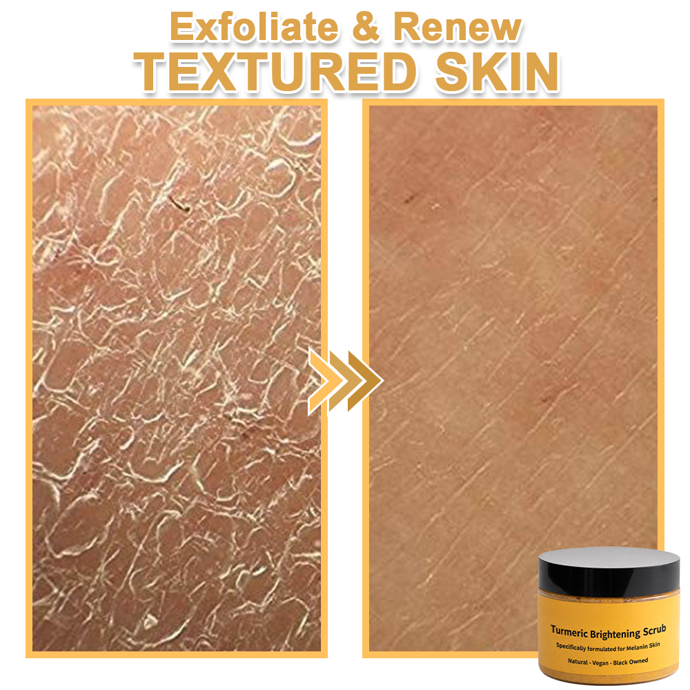 ✨️BUY 2 GET 1 FREE✨️Turmeric Exfoliating For Face & Body Scrub-Celsiora®