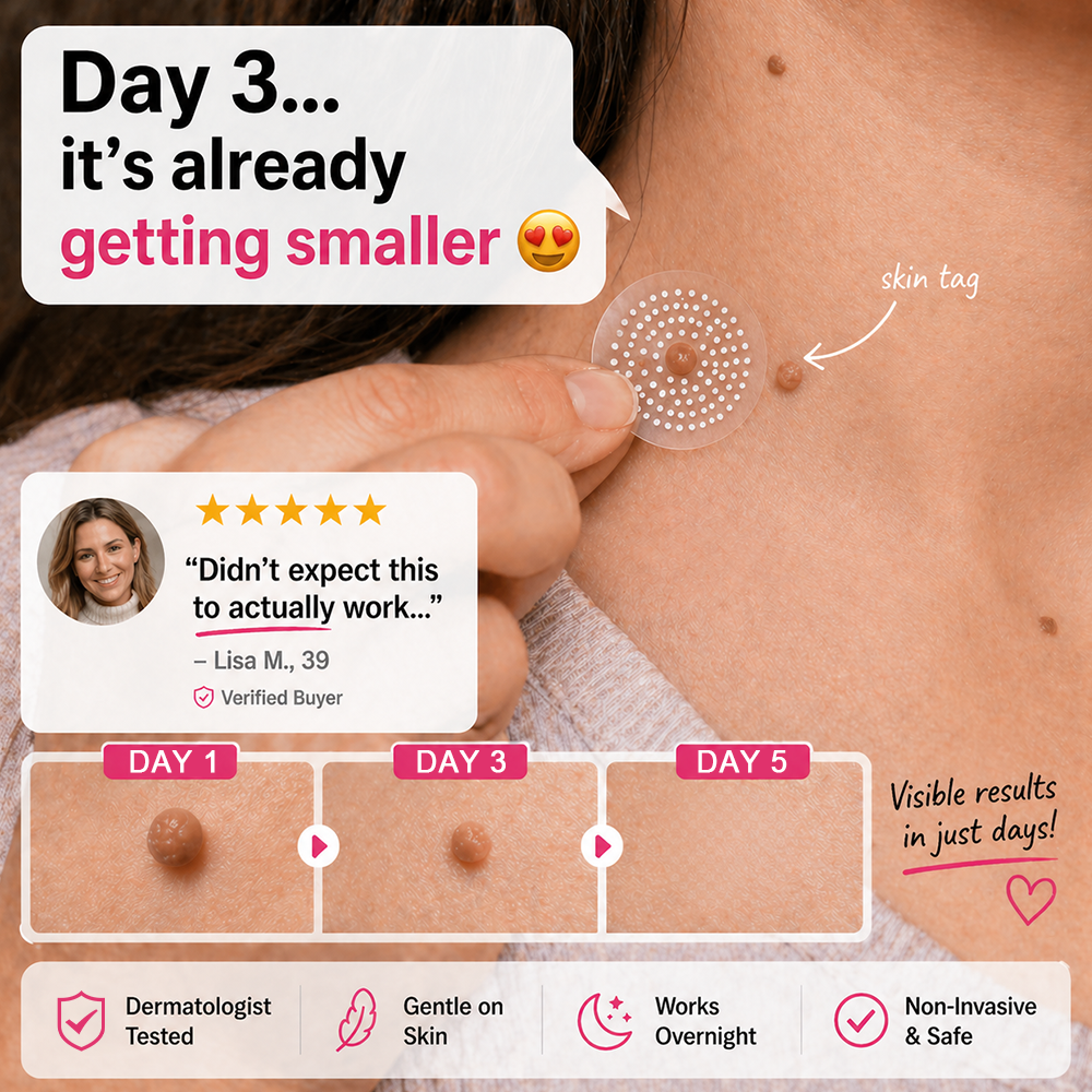 upsell🎀Celsiora® 2-in-1 Microneedle & Hydrocolloid Patch | Raised Moles,Acne,  Flat Warts & Skin Tags Remover | Improves Wrinkles, Scars & Blemishes | Invisible Pimple Patches for Face & Body