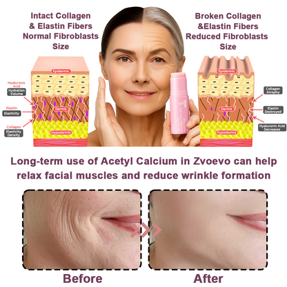 Celsiora® PDRN Collagen Repair Balm (Targets wrinkles and fine lines, smooths nasolabial folds and neck wrinkles, reduces frown lines and crow's feet)