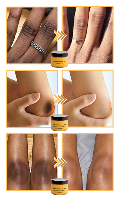 ✨️BUY 2 GET 1 FREE✨️Turmeric Exfoliating For Face & Body Scrub-Celsiora®