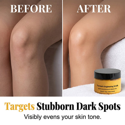 🔥BUY 2 GET 1 FREE🔥Turmeric Exfoliating Body Scrub-Celsiora®